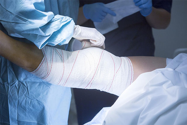 Joint Replacement Surgery